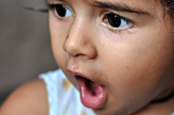 Surprised Kid